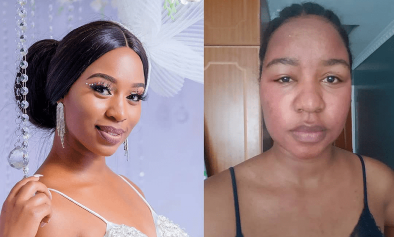 diana marua comes clean about her struggle with acne and hormonal breakouts 2