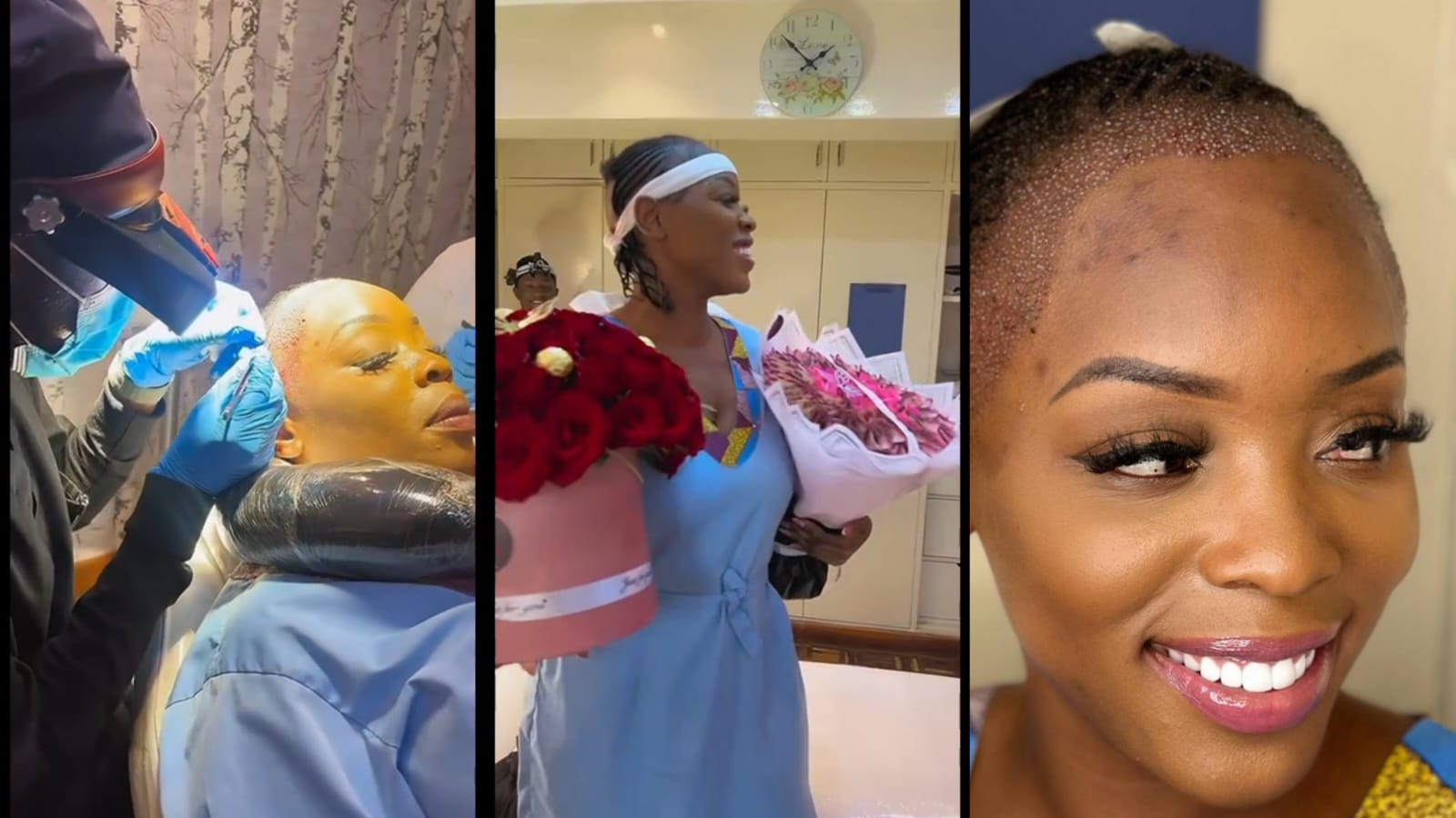 Risper faith undergoes hairline restoration procedure